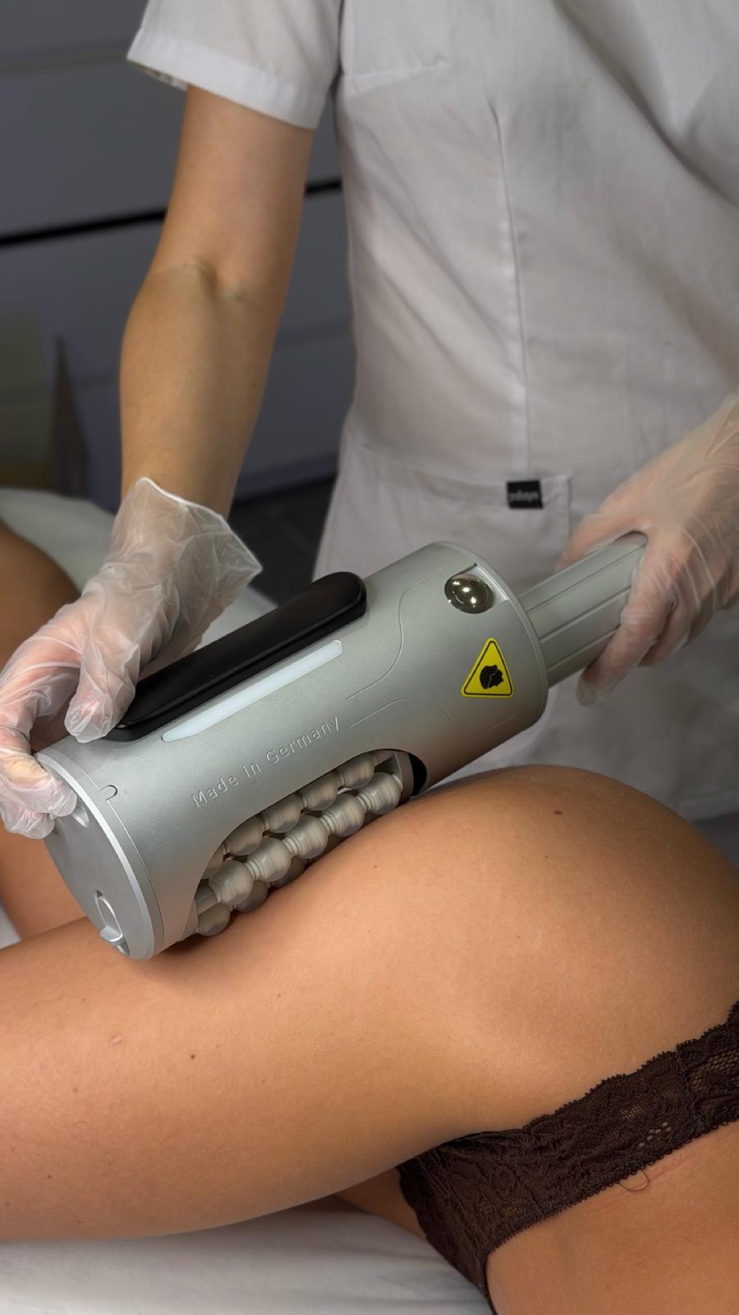 Stratosphere-behandling mot celluliter på låren hos Skinlab Lund